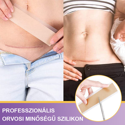 Vitalisys® Hyaluronsavas Nanomikrotű-hegjavító Tapasz🍇