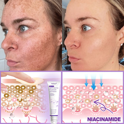 Vitalisys®🎉 PDRN Multi-Peptide Masszírozó Testgörgő Krém – Anti-aging, hidratáló, bőr megerősítő és emelő hatású, bőrápoló, egyenletes színű, pattanások és sötét foltok kezelése, szemölcsök és anyajegyek eltávolítása, valamint pikkelysömör enyhítése.