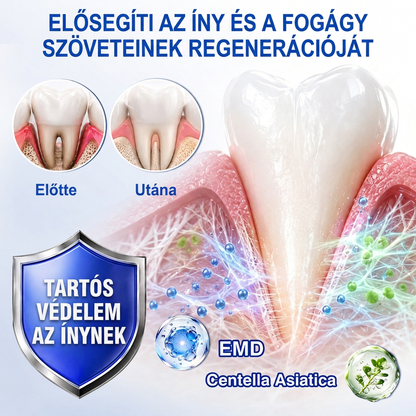 🇭🇺💎𝑽𝒊𝒕𝒂𝒍𝒊𝒔𝒚𝒔®🦷 𝑮𝒖𝒎𝑹𝒆𝒗𝒊𝒗𝒆 𝑷𝒂𝒓𝒐𝒅𝒐𝒏𝒕á𝒍𝒊𝒔 𝑱𝒂𝒗í𝒕ó 𝑮é𝒍🍎