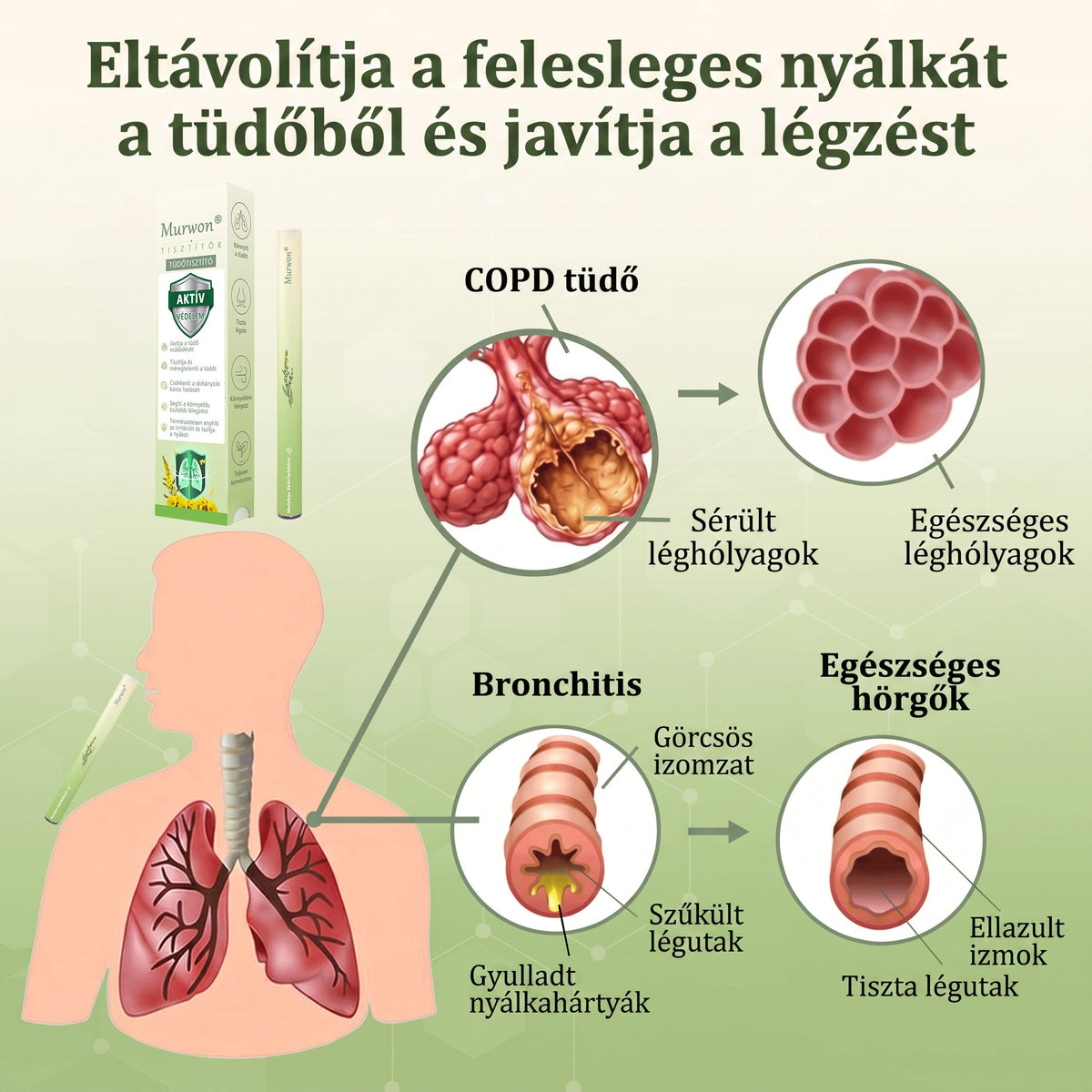 🇭🇺 Kiváló minőségű magyar termék, hazai szállítással ❤️ Murwon® gyógynövényes tüdőtisztító párologtató 🥐(👨‍⚕️ Hatékony segítség: köhögés, torokgyulladás, légszomj, váladékképződés, orrdugulás, hörghurut, allergiás tünetek és tüdőpanaszok esetén)