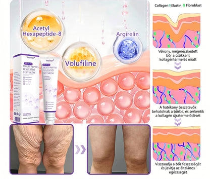 Vitalisys®🎉 PDRN Multi-Peptide Masszírozó Testgörgő Krém – Anti-aging, hidratáló, bőr megerősítő és emelő hatású, bőrápoló, egyenletes színű, pattanások és sötét foltok kezelése, szemölcsök és anyajegyek eltávolítása, valamint pikkelysömör enyhítése.
