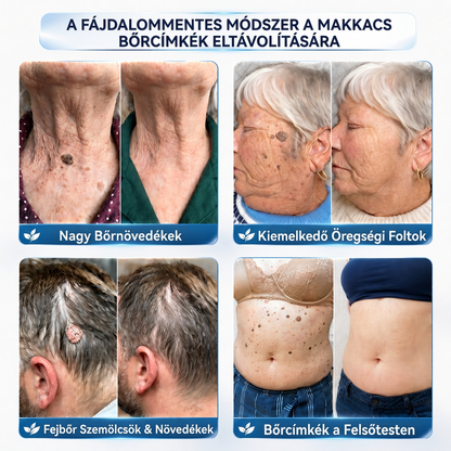👩‍⚕️♥️Vitalisys® 𝟕 𝐧𝐚𝐩𝐨𝐬 𝐛ő𝐫𝐟ü𝐠𝐠𝐞𝐥𝐲 é𝐬 𝐟𝐨𝐥𝐭𝐞𝐥𝐭á𝐯𝐨𝐥í𝐭ó 𝐤𝐫é𝐦 (𝐅𝐚𝐣𝐝𝐚𝐥𝐨𝐦𝐦𝐞𝐧𝐭𝐞𝐬 𝐟𝐨𝐫𝐦𝐮𝐥𝐚 – 𝐇𝐞𝐠𝐞𝐝é𝐬𝐞𝐤 𝐧é𝐥𝐤ü𝐥) 👍🍉