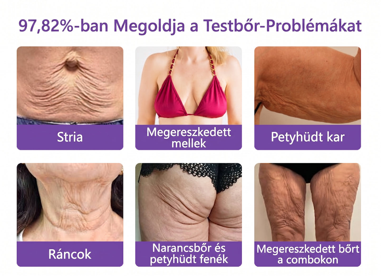 Vitalisys®🎉 PDRN Multi-Peptide Masszírozó Testgörgő Krém – Anti-aging, hidratáló, bőr megerősítő és emelő hatású, bőrápoló, egyenletes színű, pattanások és sötét foltok kezelése, szemölcsök és anyajegyek eltávolítása, valamint pikkelysömör enyhítése.