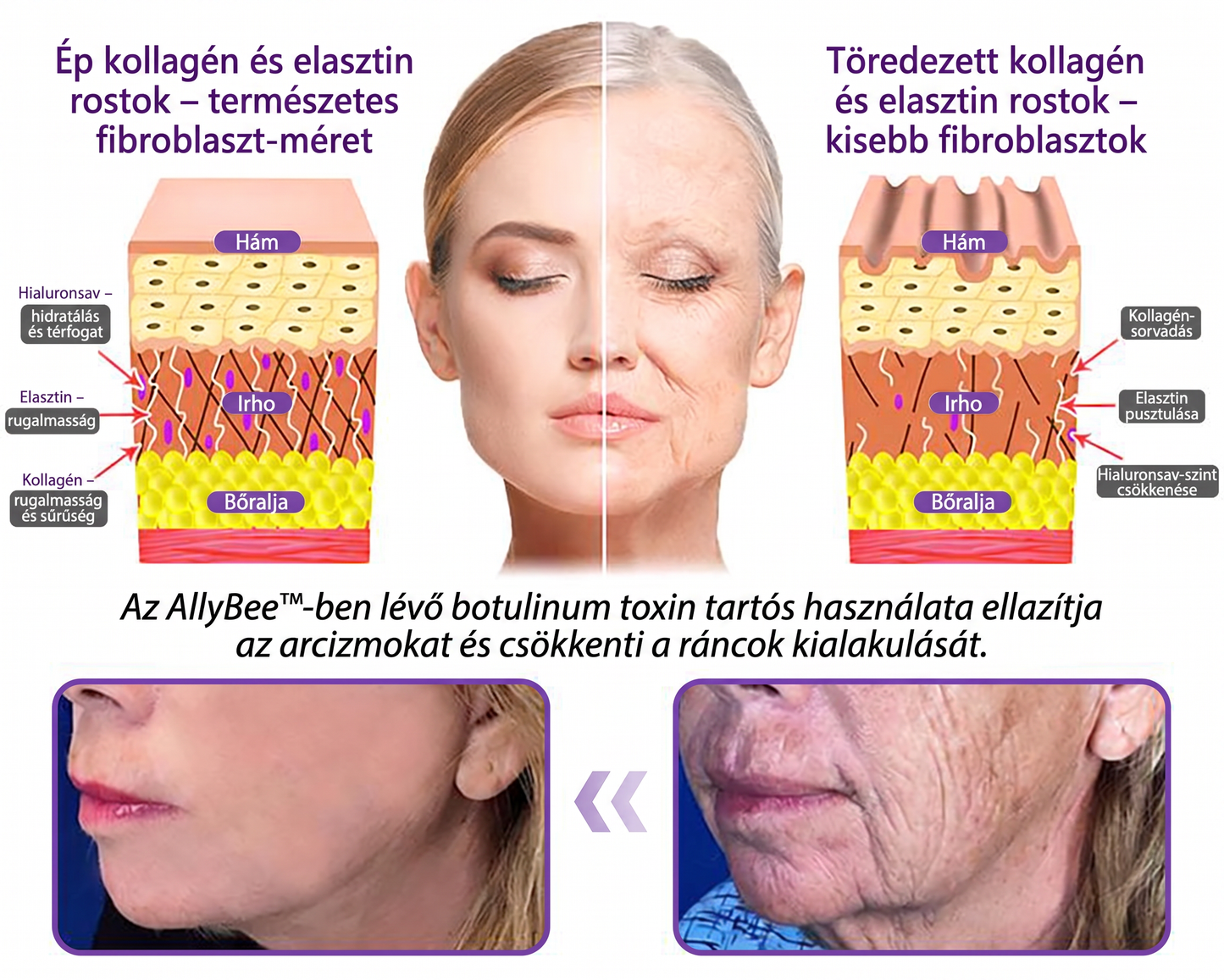 Vitalisys®🎉 PDRN Multi-Peptide Masszírozó Testgörgő Krém – Anti-aging, hidratáló, bőr megerősítő és emelő hatású, bőrápoló, egyenletes színű, pattanások és sötét foltok kezelése, szemölcsök és anyajegyek eltávolítása, valamint pikkelysömör enyhítése.