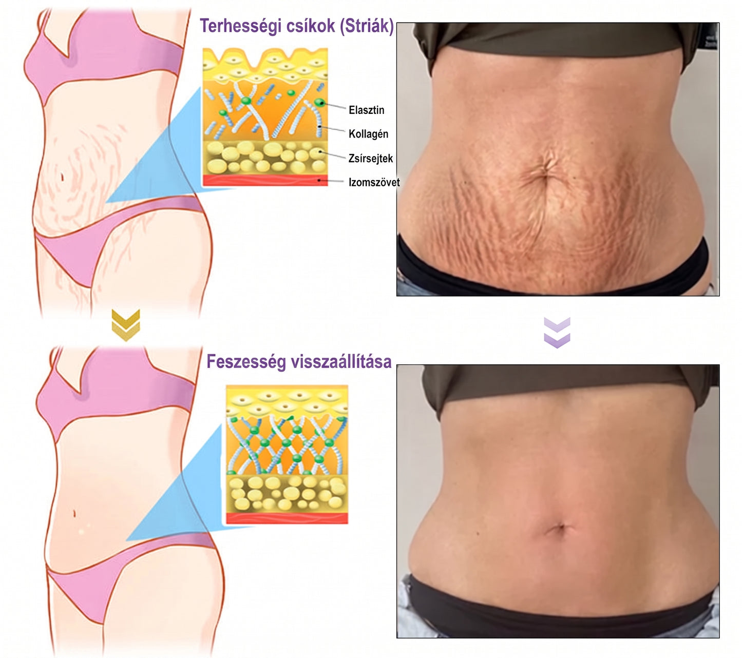 Vitalisys®🎉 PDRN Multi-Peptide Masszírozó Testgörgő Krém – Anti-aging, hidratáló, bőr megerősítő és emelő hatású, bőrápoló, egyenletes színű, pattanások és sötét foltok kezelése, szemölcsök és anyajegyek eltávolítása, valamint pikkelysömör enyhítése.