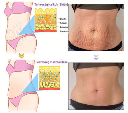 Vitalisys®🎉 PDRN Multi-Peptide Masszírozó Testgörgő Krém – Anti-aging, hidratáló, bőr megerősítő és emelő hatású, bőrápoló, egyenletes színű, pattanások és sötét foltok kezelése, szemölcsök és anyajegyek eltávolítása, valamint pikkelysömör enyhítése.