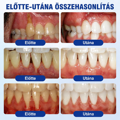 🇭🇺💎𝑽𝒊𝒕𝒂𝒍𝒊𝒔𝒚𝒔®🦷 𝑮𝒖𝒎𝑹𝒆𝒗𝒊𝒗𝒆 𝑷𝒂𝒓𝒐𝒅𝒐𝒏𝒕á𝒍𝒊𝒔 𝑱𝒂𝒗í𝒕ó 𝑮é𝒍🍎