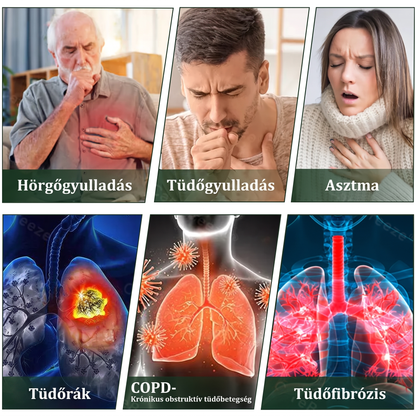 🇭🇺 Kiváló minőségű magyar termék, hazai szállítással ❤️ Murwon® gyógynövényes tüdőtisztító párologtató 🥐(👨‍⚕️ Hatékony segítség: köhögés, torokgyulladás, légszomj, váladékképződés, orrdugulás, hörghurut, allergiás tünetek és tüdőpanaszok esetén)