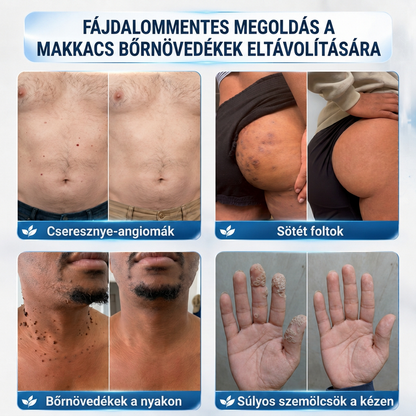 👩‍⚕️🎉 𝑶𝒇𝒇𝒊𝒛𝒊𝒆𝒍𝒍𝒆𝒓 𝑺𝒕𝒐𝒓𝒆 | 𝑵𝐞𝒌𝐢𝐬𝐬®  𝑴𝒊𝒌𝒓𝒐𝒏𝒂𝒅𝒆𝒍𝒏 𝑴𝒂𝒌𝒆𝒍𝒍𝒐𝒔𝒆 𝑯𝒂𝒖𝒕 𝑯𝒂𝒖𝒕 𝑾𝒂𝒓𝒛𝒆 𝑬𝒏𝒕𝒇𝒆𝒓𝒏𝒖𝒏𝒈 𝑷𝒇𝒍𝒂𝒔𝒕𝒆𝒓 (𝐹ü𝑟 𝐻𝑎𝑢𝑡𝑎𝑛ℎä𝑛𝑔𝑠𝑒𝑙, 𝑘𝑙𝑒𝑖𝑛𝑒 𝐻𝑎𝑢𝑡𝑤𝑢𝑐ℎ𝑒𝑟𝑢𝑛𝑔𝑒𝑛, 𝑊𝑎𝑟𝑧𝑒𝑛, 𝑀𝑢𝑡𝑡𝑒𝑟𝑚𝑎𝑙𝑒, 𝐴𝑙𝑡𝑒𝑟𝑠𝑓𝑙𝑒𝑐𝑘𝑒𝑛 𝑢𝑛𝑑 𝑃𝑖𝑔𝑚𝑒𝑛𝑡𝑠𝑡ö𝑟𝑢𝑛𝑔𝑒𝑛.)🍋