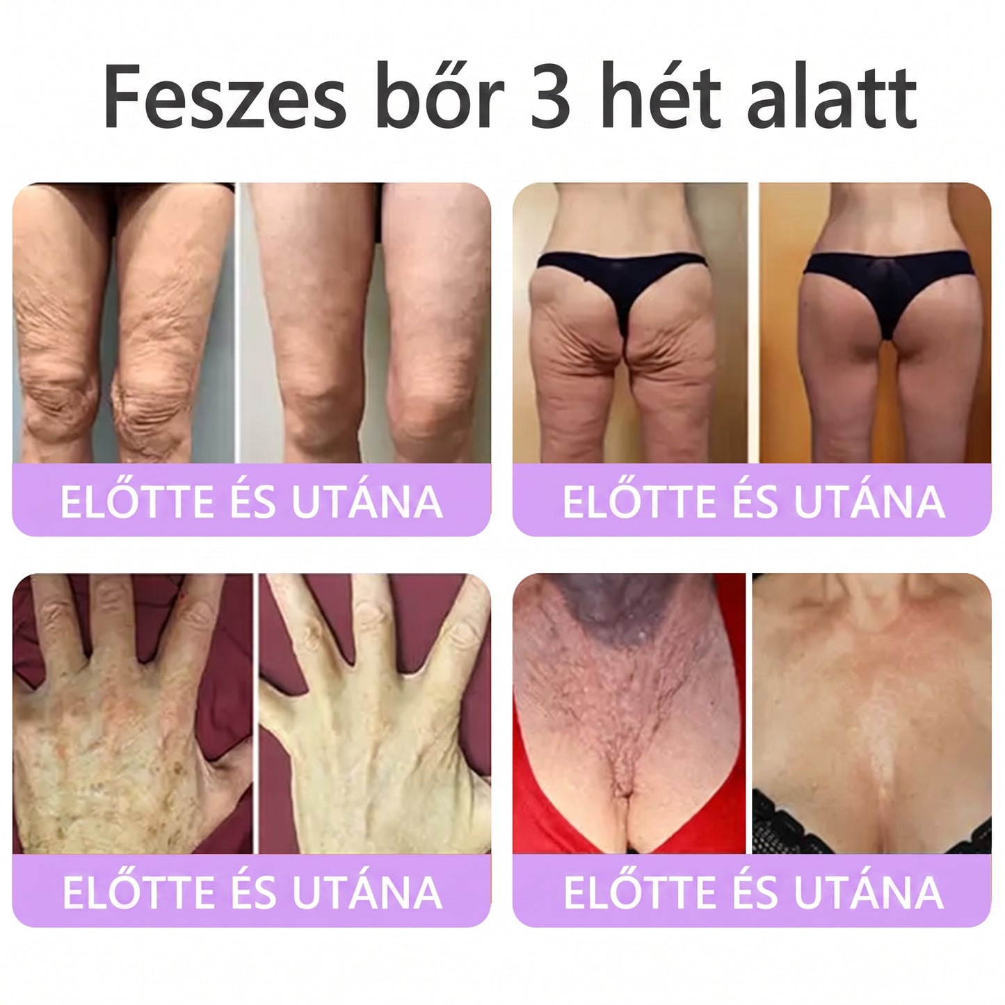 Vitalisys®🎉 PDRN Multi-Peptide Masszírozó Testgörgő Krém – Anti-aging, hidratáló, bőr megerősítő és emelő hatású, bőrápoló, egyenletes színű, pattanások és sötét foltok kezelése, szemölcsök és anyajegyek eltávolítása, valamint pikkelysömör enyhítése.