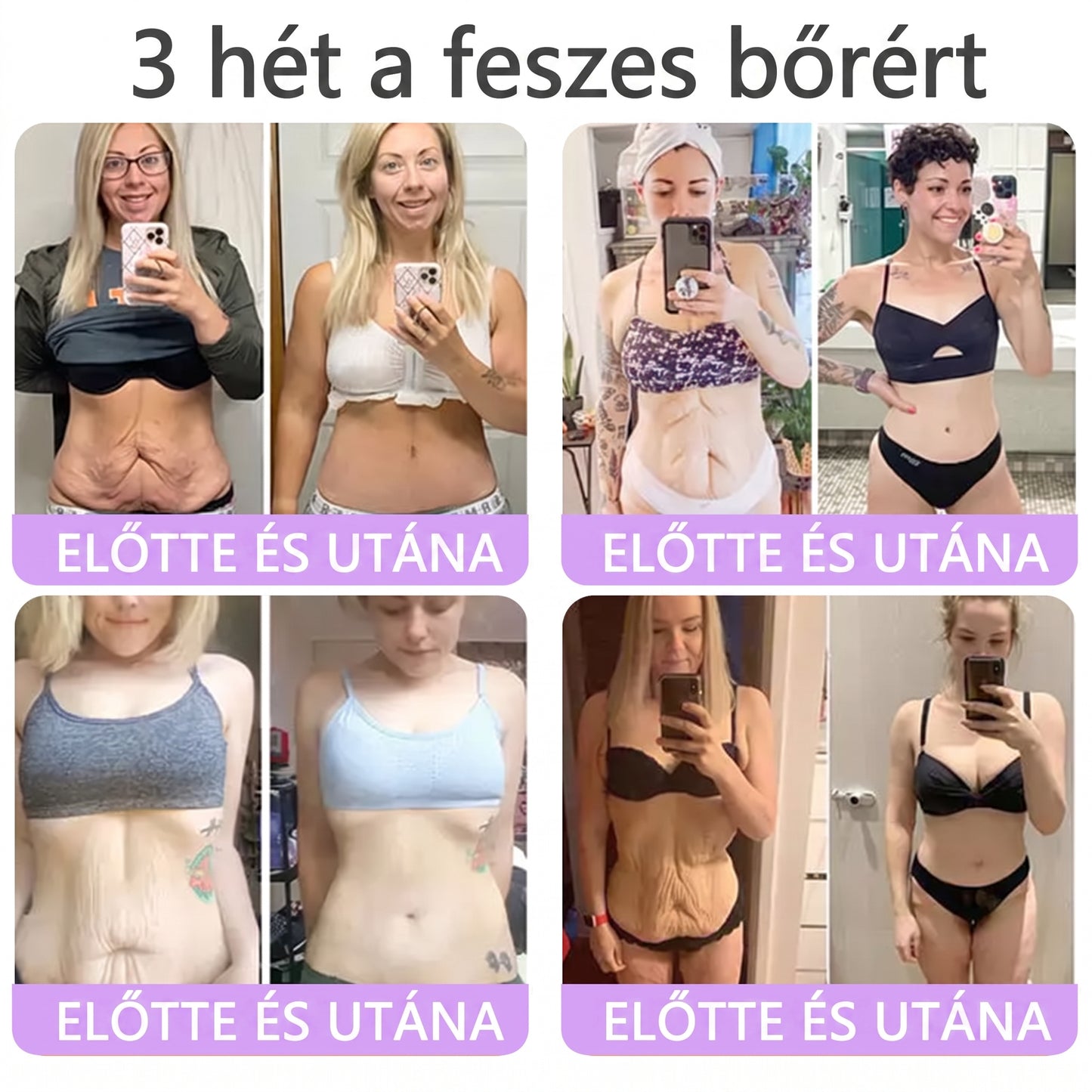 Vitalisys®🎉 PDRN Multi-Peptide Masszírozó Testgörgő Krém – Anti-aging, hidratáló, bőr megerősítő és emelő hatású, bőrápoló, egyenletes színű, pattanások és sötét foltok kezelése, szemölcsök és anyajegyek eltávolítása, valamint pikkelysömör enyhítése.