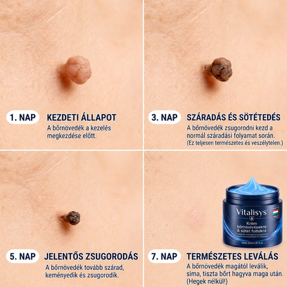 👩‍⚕️♥️Vitalisys® 𝟕 𝐧𝐚𝐩𝐨𝐬 𝐛ő𝐫𝐟ü𝐠𝐠𝐞𝐥𝐲 é𝐬 𝐟𝐨𝐥𝐭𝐞𝐥𝐭á𝐯𝐨𝐥í𝐭ó 𝐤𝐫é𝐦 (𝐅𝐚𝐣𝐝𝐚𝐥𝐨𝐦𝐦𝐞𝐧𝐭𝐞𝐬 𝐟𝐨𝐫𝐦𝐮𝐥𝐚 – 𝐇𝐞𝐠𝐞𝐝é𝐬𝐞𝐤 𝐧é𝐥𝐤ü𝐥) 👍🍉