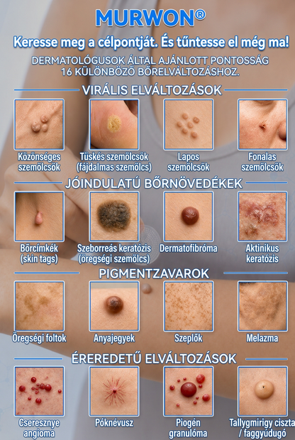 👩‍⚕️🎉 𝑶𝒇𝒇𝒊𝒛𝒊𝒆𝒍𝒍𝒆𝒓 𝑺𝒕𝒐𝒓𝒆 | 𝑵𝐞𝒌𝐢𝐬𝐬®  𝑴𝒊𝒌𝒓𝒐𝒏𝒂𝒅𝒆𝒍𝒏 𝑴𝒂𝒌𝒆𝒍𝒍𝒐𝒔𝒆 𝑯𝒂𝒖𝒕 𝑯𝒂𝒖𝒕 𝑾𝒂𝒓𝒛𝒆 𝑬𝒏𝒕𝒇𝒆𝒓𝒏𝒖𝒏𝒈 𝑷𝒇𝒍𝒂𝒔𝒕𝒆𝒓 (𝐹ü𝑟 𝐻𝑎𝑢𝑡𝑎𝑛ℎä𝑛𝑔𝑠𝑒𝑙, 𝑘𝑙𝑒𝑖𝑛𝑒 𝐻𝑎𝑢𝑡𝑤𝑢𝑐ℎ𝑒𝑟𝑢𝑛𝑔𝑒𝑛, 𝑊𝑎𝑟𝑧𝑒𝑛, 𝑀𝑢𝑡𝑡𝑒𝑟𝑚𝑎𝑙𝑒, 𝐴𝑙𝑡𝑒𝑟𝑠𝑓𝑙𝑒𝑐𝑘𝑒𝑛 𝑢𝑛𝑑 𝑃𝑖𝑔𝑚𝑒𝑛𝑡𝑠𝑡ö𝑟𝑢𝑛𝑔𝑒𝑛.)🍋