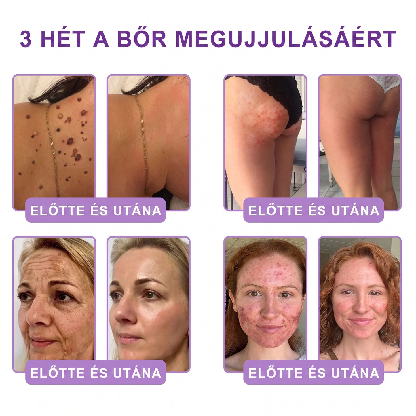 Vitalisys®🎉 PDRN Multi-Peptide Masszírozó Testgörgő Krém – Anti-aging, hidratáló, bőr megerősítő és emelő hatású, bőrápoló, egyenletes színű, pattanások és sötét foltok kezelése, szemölcsök és anyajegyek eltávolítása, valamint pikkelysömör enyhítése.