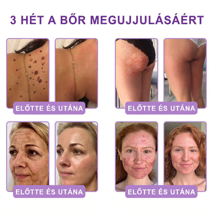 Vitalisys®🎉 PDRN Multi-Peptide Masszírozó Testgörgő Krém – Anti-aging, hidratáló, bőr megerősítő és emelő hatású, bőrápoló, egyenletes színű, pattanások és sötét foltok kezelése, szemölcsök és anyajegyek eltávolítása, valamint pikkelysömör enyhítése.