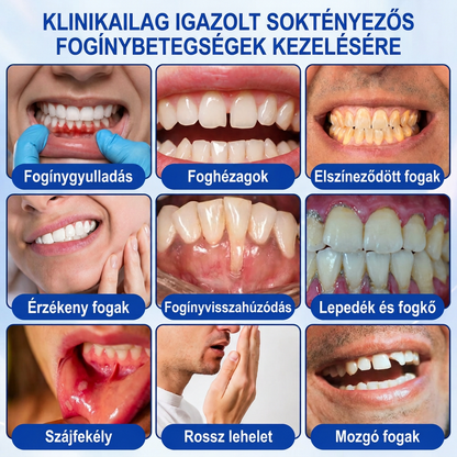 🇭🇺💎𝑽𝒊𝒕𝒂𝒍𝒊𝒔𝒚𝒔®🦷 𝑮𝒖𝒎𝑹𝒆𝒗𝒊𝒗𝒆 𝑷𝒂𝒓𝒐𝒅𝒐𝒏𝒕á𝒍𝒊𝒔 𝑱𝒂𝒗í𝒕ó 𝑮é𝒍🍎