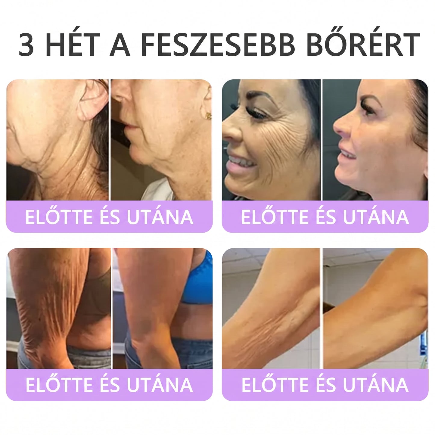 Vitalisys®🎉 PDRN Multi-Peptide Masszírozó Testgörgő Krém – Anti-aging, hidratáló, bőr megerősítő és emelő hatású, bőrápoló, egyenletes színű, pattanások és sötét foltok kezelése, szemölcsök és anyajegyek eltávolítása, valamint pikkelysömör enyhítése.