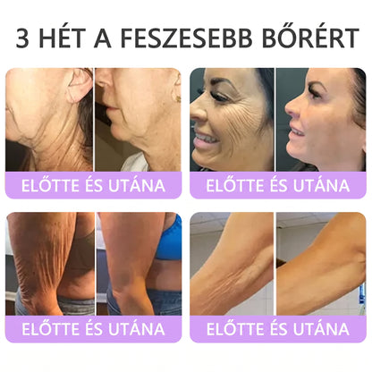Vitalisys®🎉 PDRN Multi-Peptide Masszírozó Testgörgő Krém – Anti-aging, hidratáló, bőr megerősítő és emelő hatású, bőrápoló, egyenletes színű, pattanások és sötét foltok kezelése, szemölcsök és anyajegyek eltávolítása, valamint pikkelysömör enyhítése.