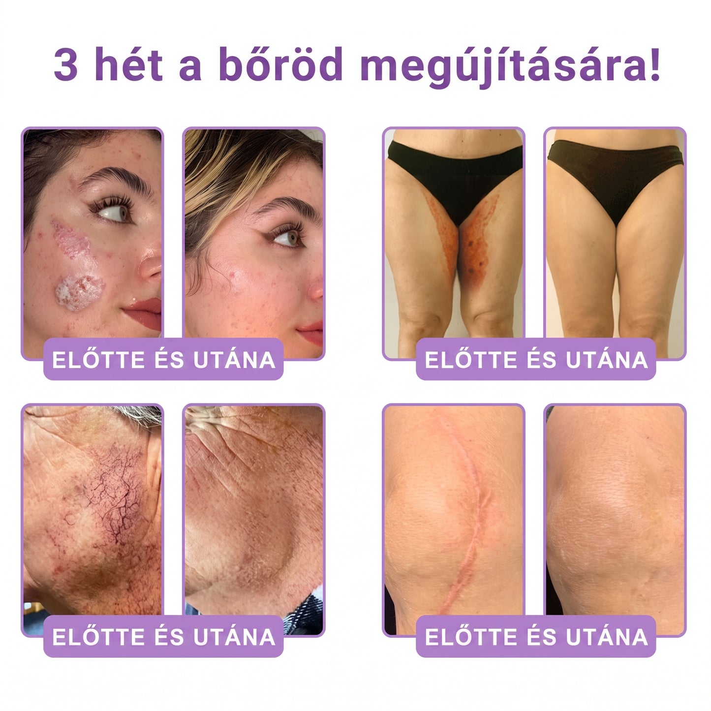 Vitalisys®🎉 PDRN Multi-Peptide Masszírozó Testgörgő Krém – Anti-aging, hidratáló, bőr megerősítő és emelő hatású, bőrápoló, egyenletes színű, pattanások és sötét foltok kezelése, szemölcsök és anyajegyek eltávolítása, valamint pikkelysömör enyhítése.