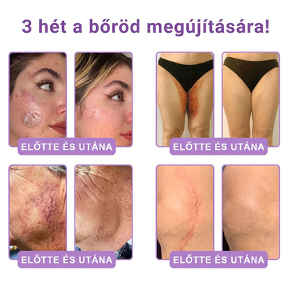 Vitalisys®🎉 PDRN Multi-Peptide Masszírozó Testgörgő Krém – Anti-aging, hidratáló, bőr megerősítő és emelő hatású, bőrápoló, egyenletes színű, pattanások és sötét foltok kezelése, szemölcsök és anyajegyek eltávolítása, valamint pikkelysömör enyhítése.