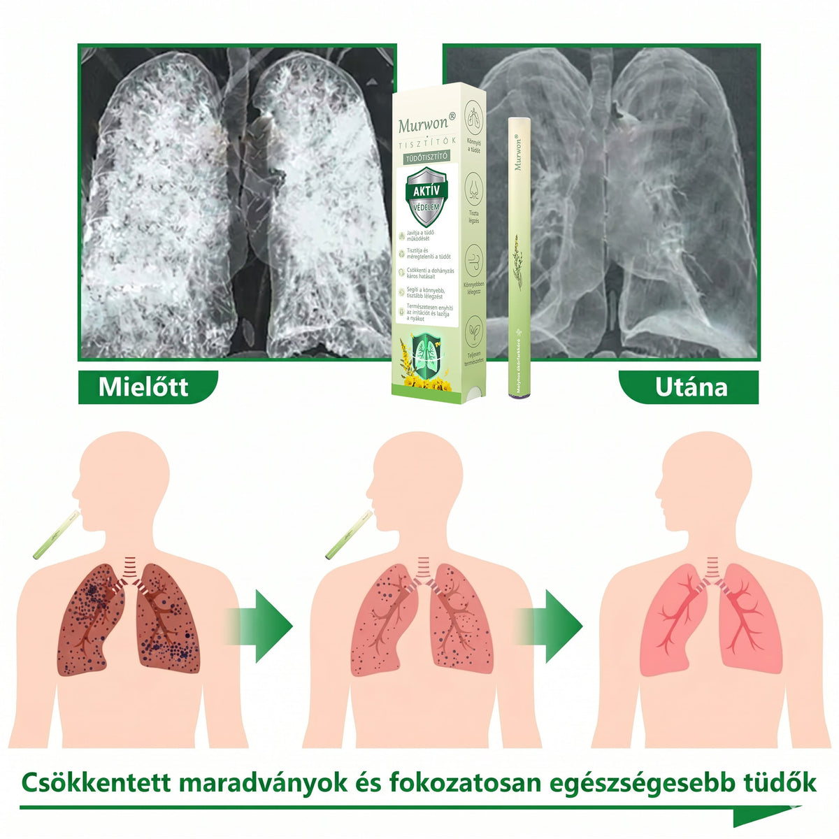 🇭🇺 Kiváló minőségű magyar termék, hazai szállítással ❤️ Murwon® gyógynövényes tüdőtisztító párologtató 🥐(👨‍⚕️ Hatékony segítség: köhögés, torokgyulladás, légszomj, váladékképződés, orrdugulás, hörghurut, allergiás tünetek és tüdőpanaszok esetén)
