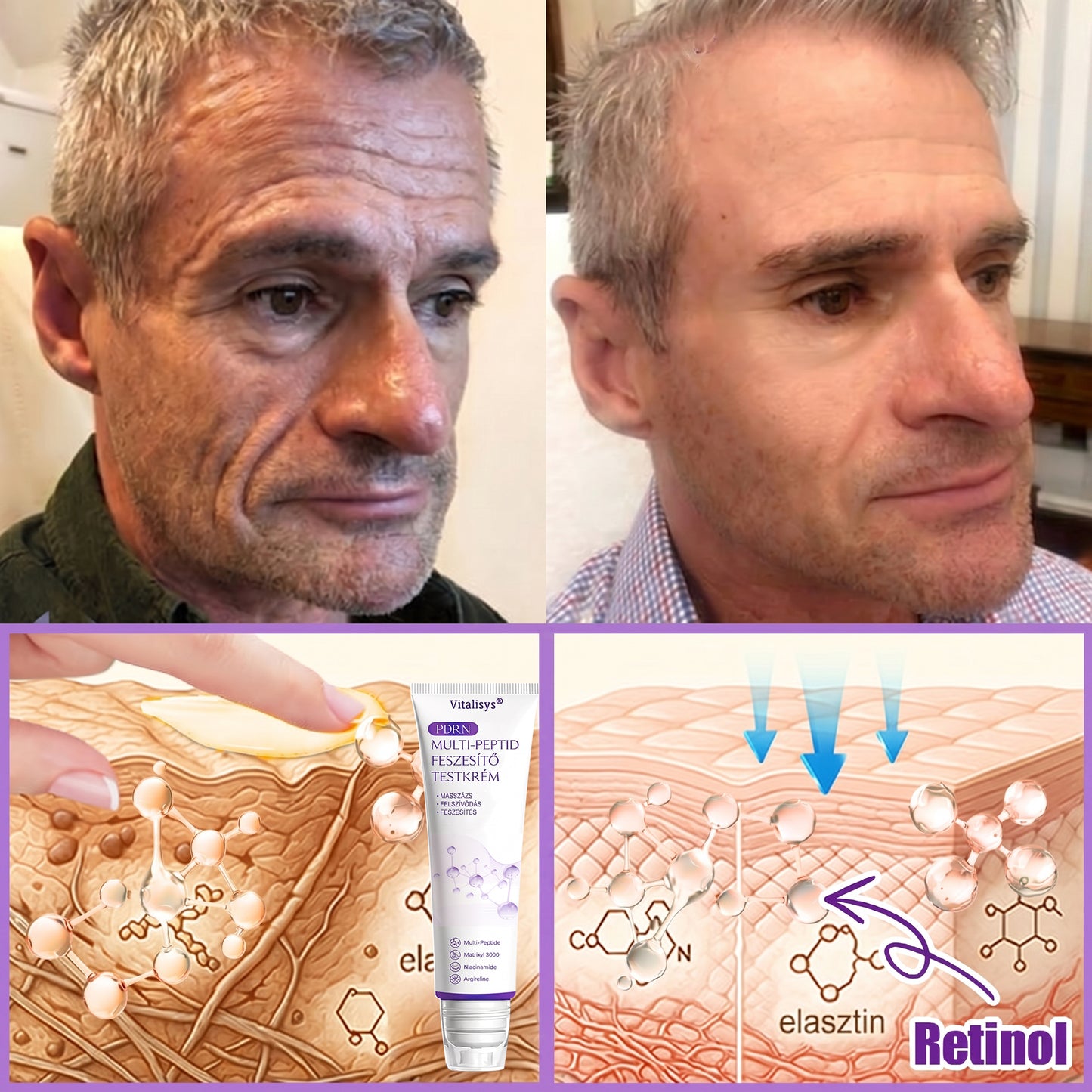 Vitalisys®🎉 PDRN Multi-Peptide Masszírozó Testgörgő Krém – Anti-aging, hidratáló, bőr megerősítő és emelő hatású, bőrápoló, egyenletes színű, pattanások és sötét foltok kezelése, szemölcsök és anyajegyek eltávolítása, valamint pikkelysömör enyhítése.