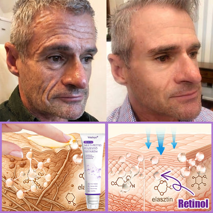 Vitalisys®🎉 PDRN Multi-Peptide Masszírozó Testgörgő Krém – Anti-aging, hidratáló, bőr megerősítő és emelő hatású, bőrápoló, egyenletes színű, pattanások és sötét foltok kezelése, szemölcsök és anyajegyek eltávolítása, valamint pikkelysömör enyhítése.