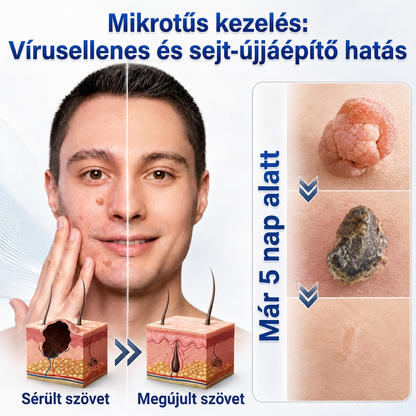 👩‍⚕️🎉 𝑶𝒇𝒇𝒊𝒛𝒊𝒆𝒍𝒍𝒆𝒓 𝑺𝒕𝒐𝒓𝒆 | 𝑵𝐞𝒌𝐢𝐬𝐬®  𝑴𝒊𝒌𝒓𝒐𝒏𝒂𝒅𝒆𝒍𝒏 𝑴𝒂𝒌𝒆𝒍𝒍𝒐𝒔𝒆 𝑯𝒂𝒖𝒕 𝑯𝒂𝒖𝒕 𝑾𝒂𝒓𝒛𝒆 𝑬𝒏𝒕𝒇𝒆𝒓𝒏𝒖𝒏𝒈 𝑷𝒇𝒍𝒂𝒔𝒕𝒆𝒓 (𝐹ü𝑟 𝐻𝑎𝑢𝑡𝑎𝑛ℎä𝑛𝑔𝑠𝑒𝑙, 𝑘𝑙𝑒𝑖𝑛𝑒 𝐻𝑎𝑢𝑡𝑤𝑢𝑐ℎ𝑒𝑟𝑢𝑛𝑔𝑒𝑛, 𝑊𝑎𝑟𝑧𝑒𝑛, 𝑀𝑢𝑡𝑡𝑒𝑟𝑚𝑎𝑙𝑒, 𝐴𝑙𝑡𝑒𝑟𝑠𝑓𝑙𝑒𝑐𝑘𝑒𝑛 𝑢𝑛𝑑 𝑃𝑖𝑔𝑚𝑒𝑛𝑡𝑠𝑡ö𝑟𝑢𝑛𝑔𝑒𝑛.)🍋