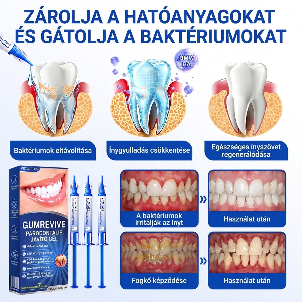 🇭🇺💎𝑽𝒊𝒕𝒂𝒍𝒊𝒔𝒚𝒔®🦷 𝑮𝒖𝒎𝑹𝒆𝒗𝒊𝒗𝒆 𝑷𝒂𝒓𝒐𝒅𝒐𝒏𝒕á𝒍𝒊𝒔 𝑱𝒂𝒗í𝒕ó 𝑮é𝒍🍎